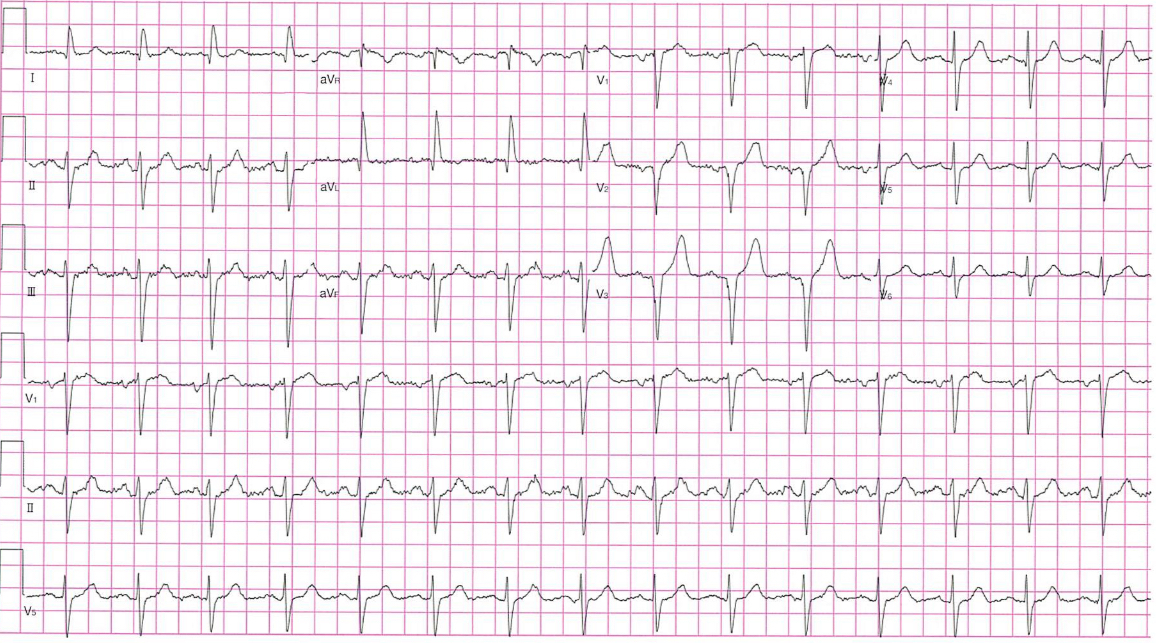 ecgmaster